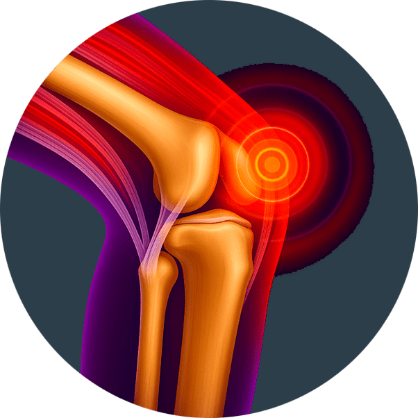 Възпаление на ставите